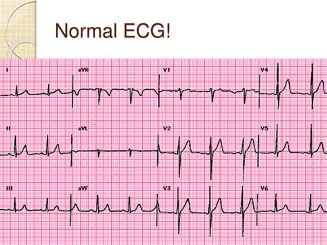 ecg result validity period philippines